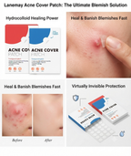 Hydrocolloid pimple patch texture close-up