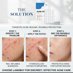 Acne patch product detail photo