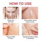 Acne patch packaging design
